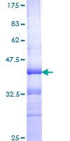 12.5% SDS-PAGE Stained with Coomassie Blue